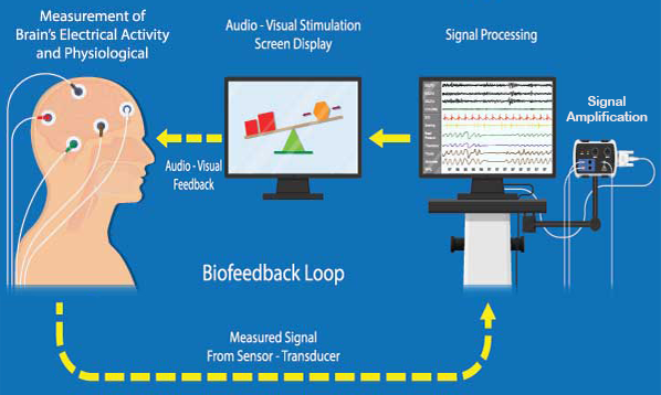NeuroFeedback Biofeedback loop